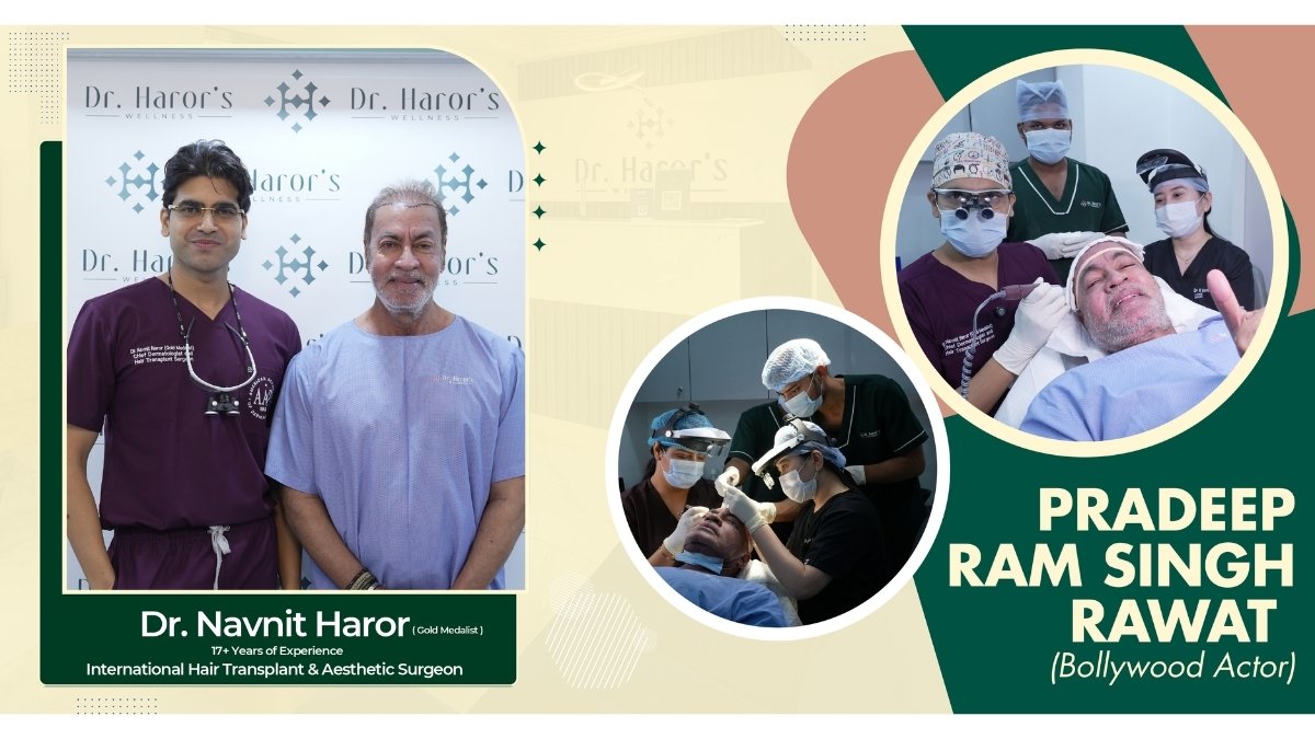 Celebrity Hair Transplant: You’d Never Guess They Had a Hair Transplant—But They Did!-PNN