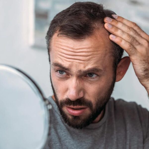 Stress-Induced Hair Fall: How Homeopathy Offers Natural Solution