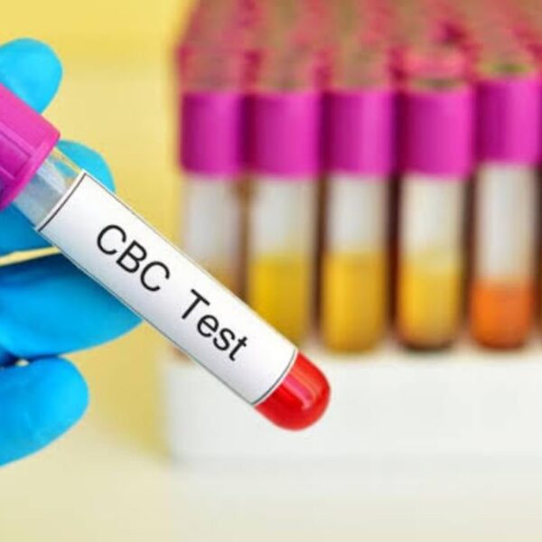 Reasons You Were Prescribed CBC Test